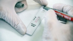 
МОЗ назвало долю украинцев с антителами к COVID-19
