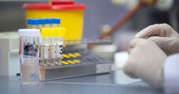 COVID-19: В Константиновке один летальный случай, в области - семь &mdash; сводка за 14 октября